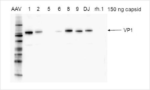 VP1 protein Analysis of AAV Capsids by Western blot VP1 protein Analysis of AAV Capsids by Western blot